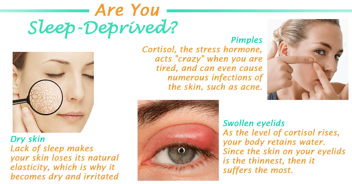 These Are the Signs That You May Be Sleep Deprived