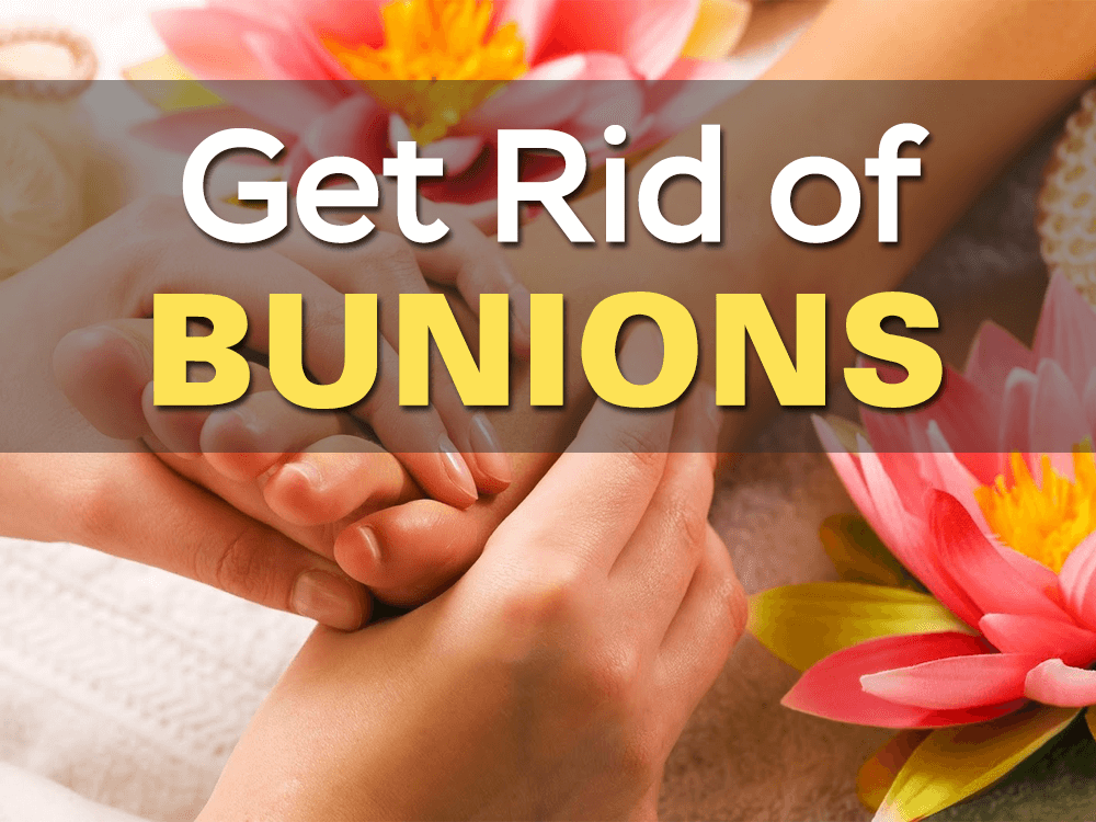 How to Get Rid of Bunions Naturally •